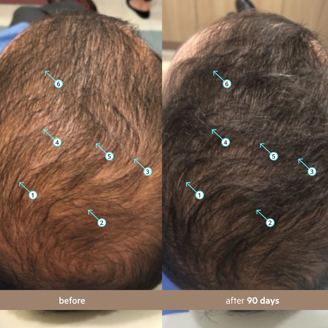 Spectral Hair Density Serum