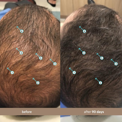 Spectral Hair Density Serum