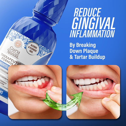 Guru nanda Gum Restoration